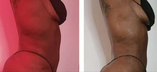 Black Ice + Metal Therapy