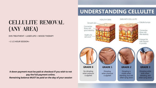 Cellulite Removal (ANY AREA)